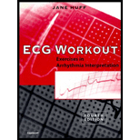 Cover Image For HUFF JA ECG WORKOUT 4/E  